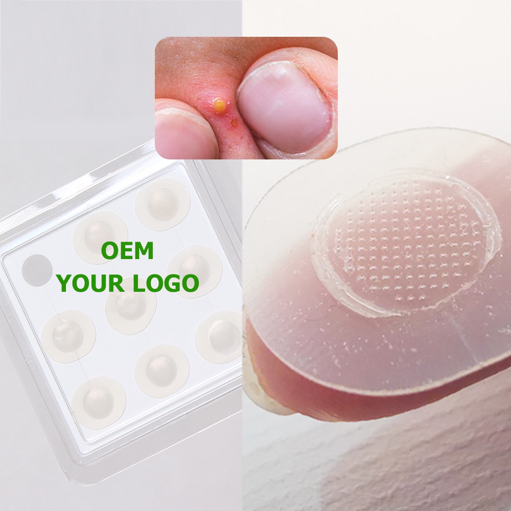 hydrocolloid patches hydrocolloid patches